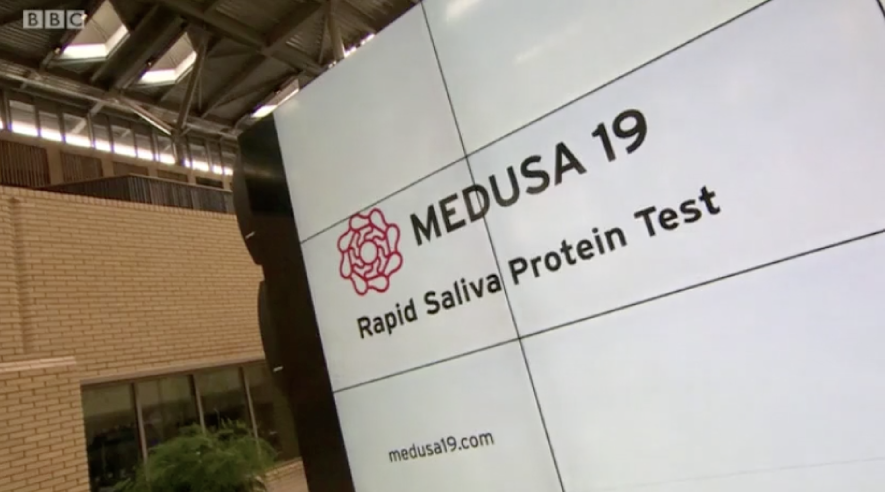 Medusa 19 rapid salive protein test