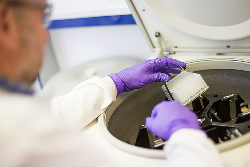 Scientist wearing purple rubber gloves working with soluble biomarkers in clinical samples